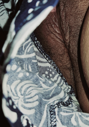 [รูปเมีย] เมียโกนหมอยออก