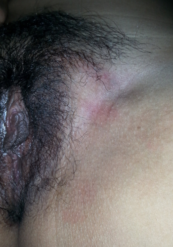 [รูปเมีย] สภาพหีหลังโดนรุมเย็ดหนักๆ